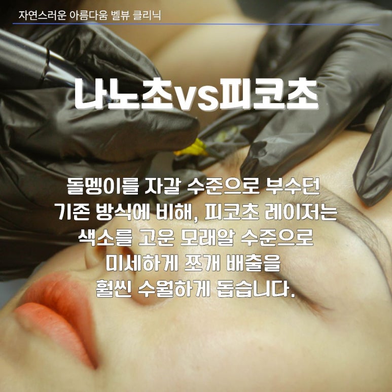 눈썹문신·타투 지우기 전 꼭 알아야 할 레이저 선택 기준 (나노초 vs 피코초) 관련 이미지 3