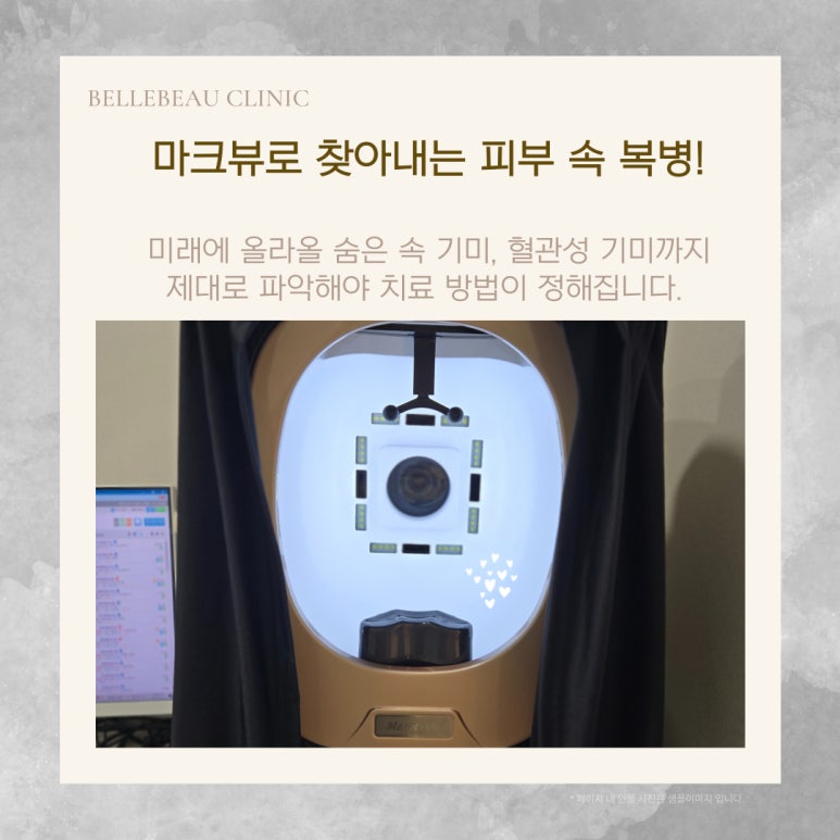 기미·잡티를 뿌리뽑는 치트키 ‘레이저 토닝 + 백옥주사’ 관련 이미지 10