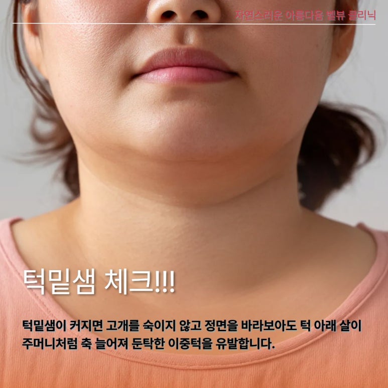 턱살인 줄 알았는데 침샘이라고? 귀밑&middot;턱밑 불룩함 해결하는 침샘 비대증 원인과 진단 관련 이미지 4