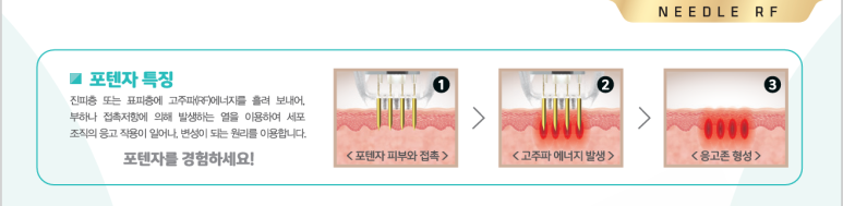 포텐자 치료 효과, 일본인에게 특히 인기인 이유는? 관련 이미지 6