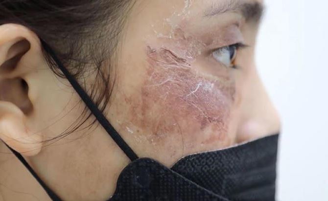 [닥터벨뷰 칼럼 40.] 피부 pH 균형, 왜 중요한가? 화장품 선택의 핵심 포인트 관련 이미지 4