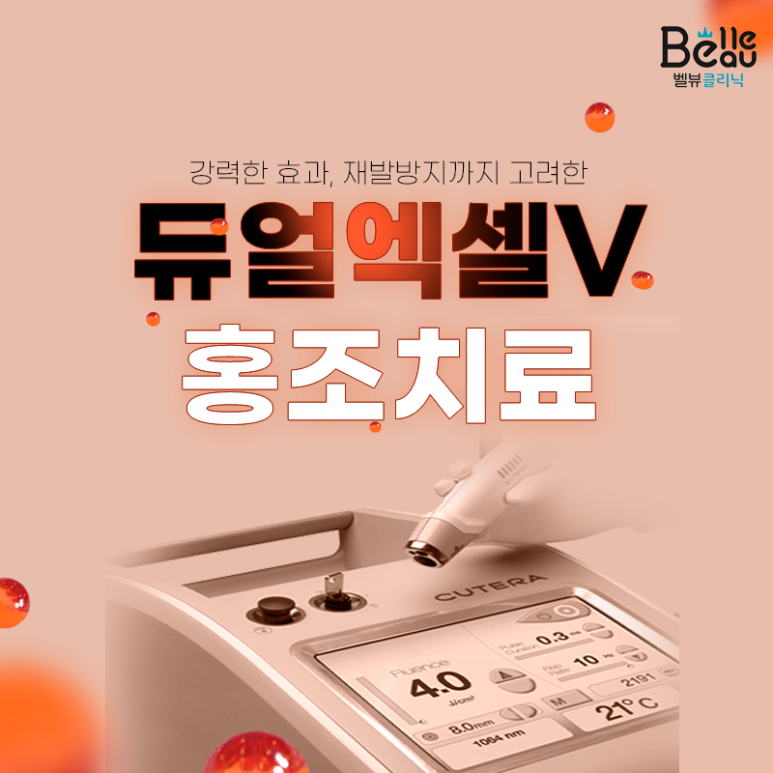 홍조치료 레이저 엑셀v를 이용한 안면홍조 치료와 효과 관련 이미지 2