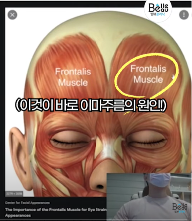 이마 미간 보톡스 이런 분들은 조심하세요 관련 이미지 5