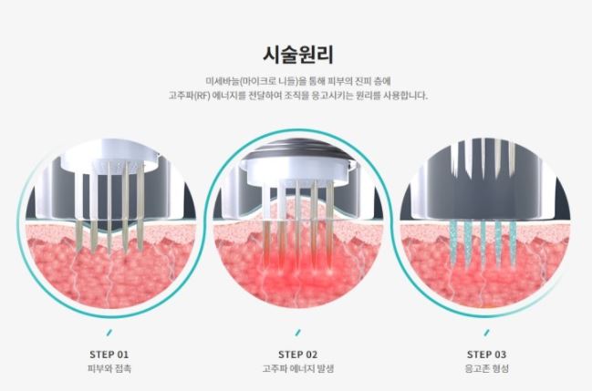 포텐자 치료 효과, 일본인에게 특히 인기인 이유는? 관련 이미지 8