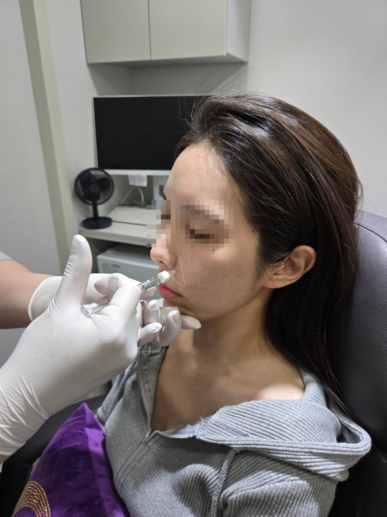 팔자주름 필러만으로 부족하다면? 4가지 관련 이미지 2