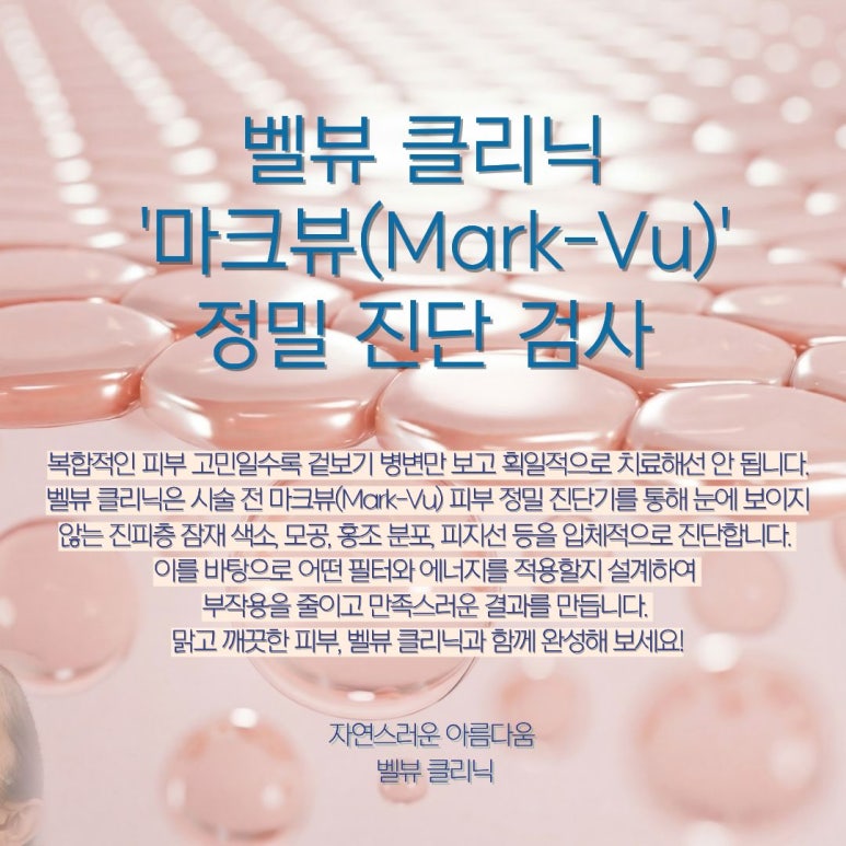 벨뷰 클리닉 셀렉브이(CelecV)레이저 치료 A to Z 관련 이미지 5
