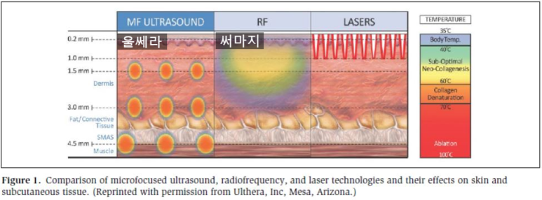 [Dr. Bellvue Column 107] Understanding the Differences Between Ultherapy and Thermage image 6