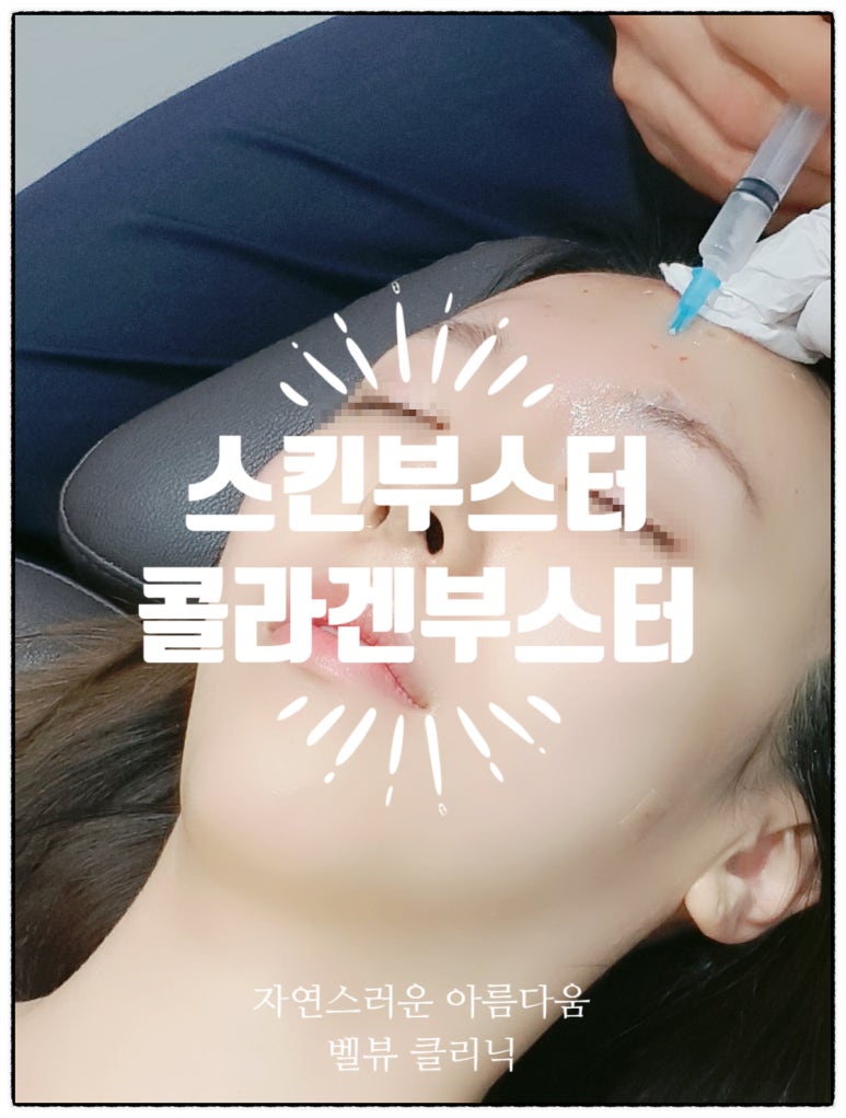 [닥터벨뷰 칼럼 35.] 스킨 부스터 VS 콜라겐 부스터 관련 이미지 6