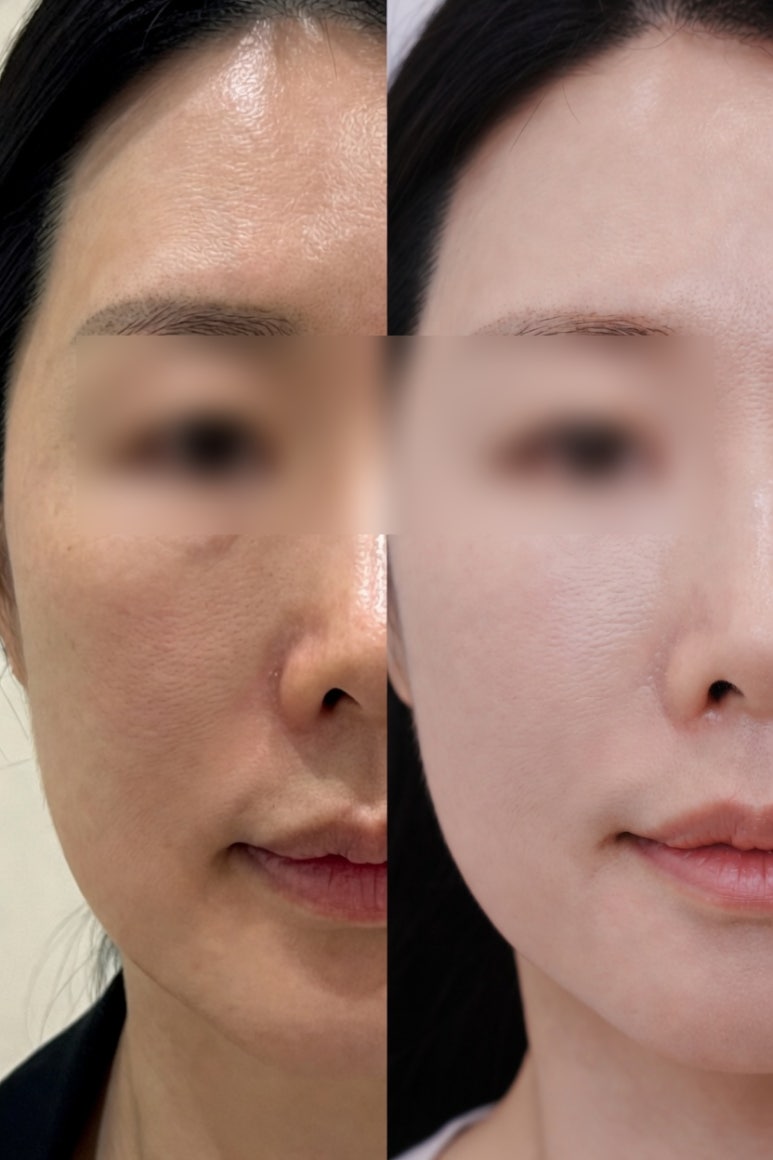 [Dr. Bellview Column 94.] Why Does My Face Still Look Dull Even Though I Have No Spots? image 8