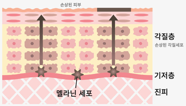 각질, 피부 건강의 숨은 동반자라는 걸 아시나요? 관련 이미지 6