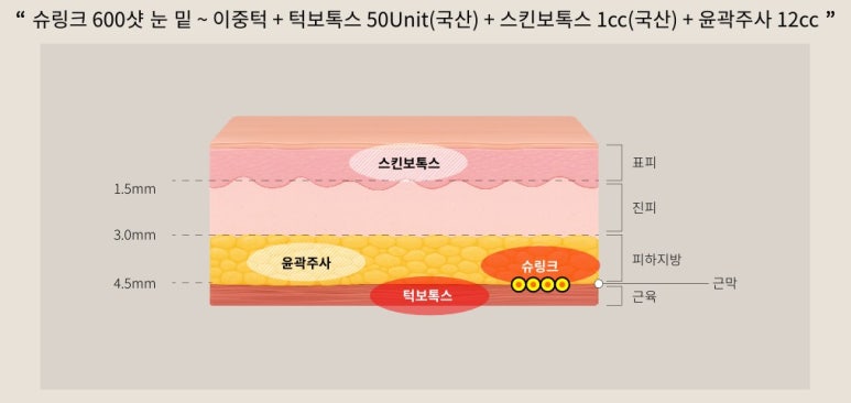 리프팅 입문자들을 위한 네 가지 프로그램, 벨뷰로 다 모여라! 관련 이미지 3