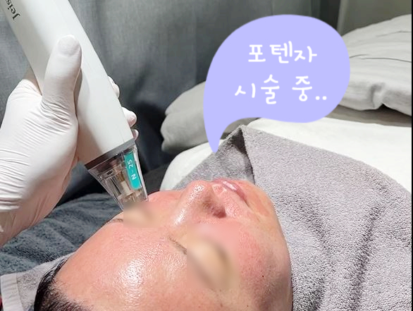 여드름 흉터 모공 해결사 [ 포텐자 + 쥬베룩 ] 관련 이미지 3