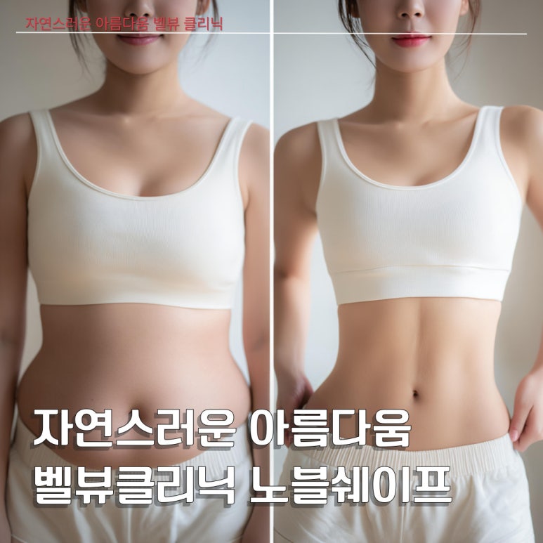 Can Your Body Line Become More Beautiful While You Lie Comfortably? Bellevue Clinic NobleShape image 1
