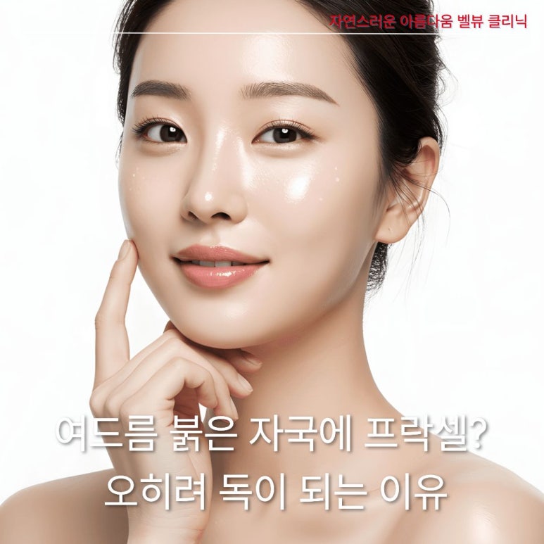 여드름 붉은 자국에 프락셀? 오히려 독이 되는 이유와 올바른 치료법 관련 이미지 1