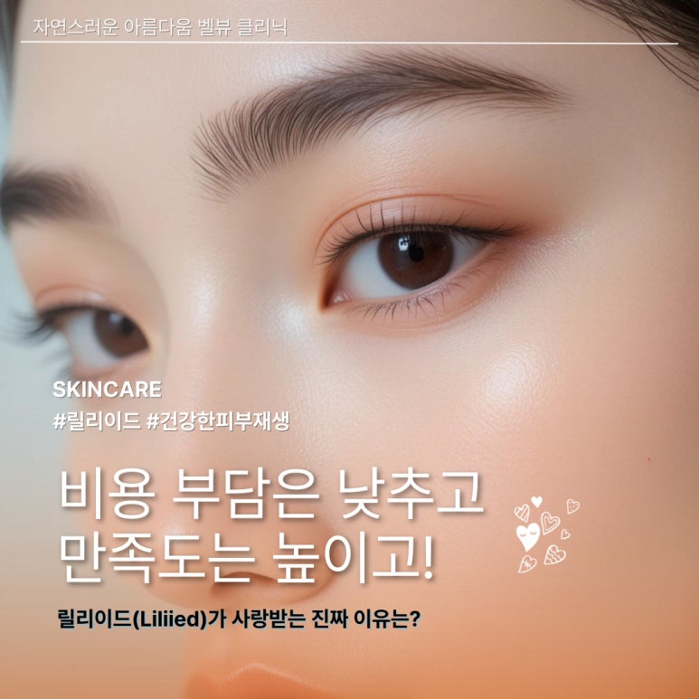 합리적 가격의 갓성비 스킨부스터 릴리이드, 5가지 중 가장 인기 많은 라인은 이것 관련 이미지 1