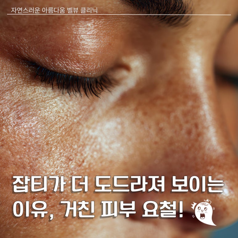 여름철 피부 자생력 떨어지는 세 가지 원인, 크라이오 진정 관리가 중요한 이유 관련 이미지 5