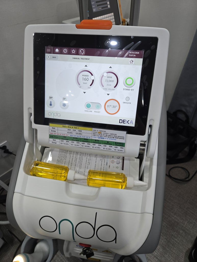 Want to Lift Sagging Cheek Fat and Reduce a Full Double Chin? We Recommend the Ultherapy + ONDA Lifting Combination image 5