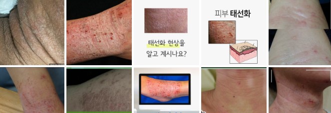때밀기, 피부 건강을 해치는 습관 중 하나 관련 이미지 4