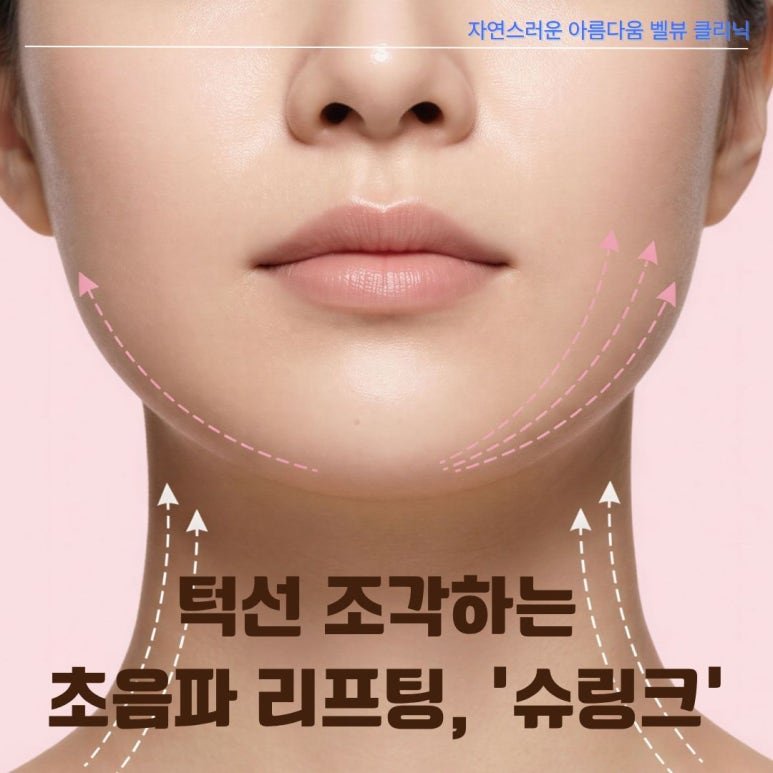 살 빼도 안 빠지는 이중턱·무너진 U라인, 슈링크로 턱선 착붙 리프팅! 관련 이미지 3