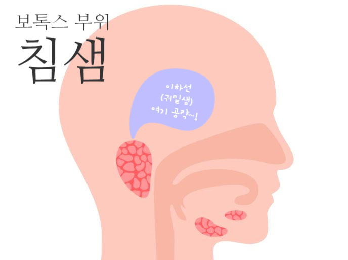침샘 보톡스 왜 유행하는 것일까? 효과와 가성비가 대박이니까! 관련 이미지 6