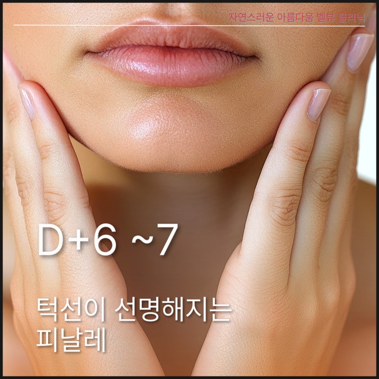 강남역 벨뷰슬림핏 후 턱선 밀착 회복 스케줄 관련 이미지 4