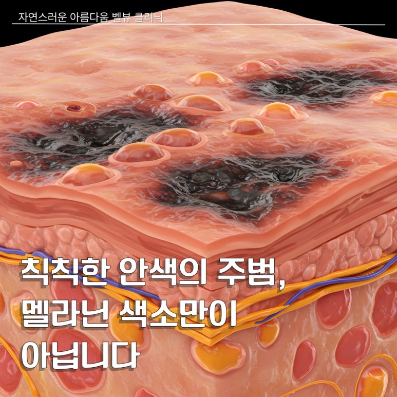 The Culprit Behind a Dull Complexion Is Not Just Melanin Pigment image 6