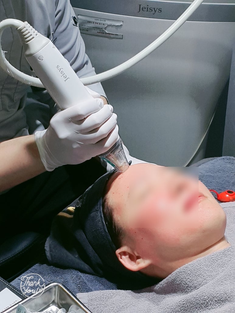 [닥터벨뷰 108.] 포텐자 레이저로 패인 여드름 흉터와 늘어진 모공을 동시에 개선하는 원리 관련 이미지 4