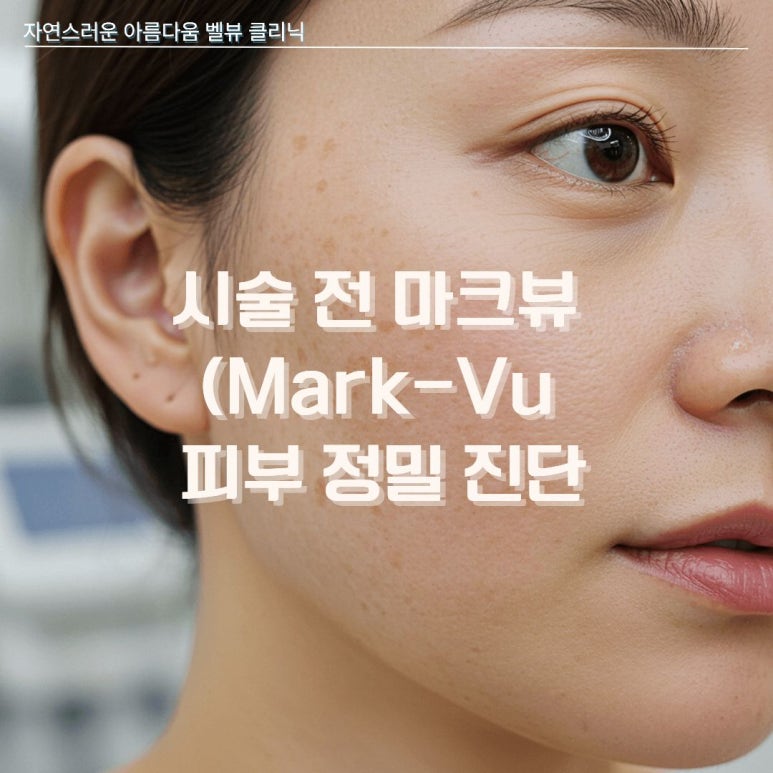 칙칙한 잡티와 난치성 기미, 왜 관련 이미지 3