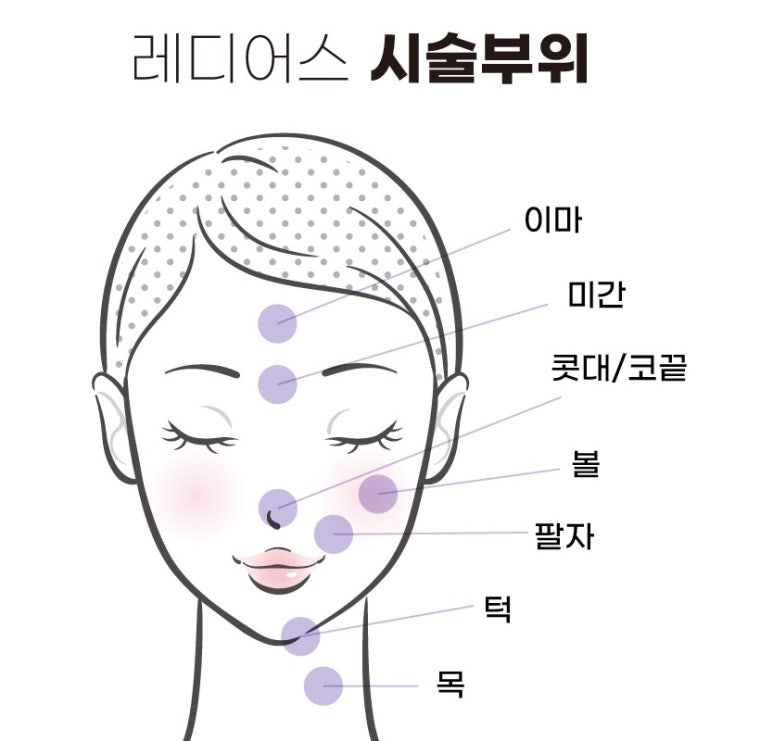 [닥터벨뷰 칼럼 55.] 확실하고 자연스럽게 피부 콜라겐을 채우는 방법 (1) 레디어스 관련 이미지 6
