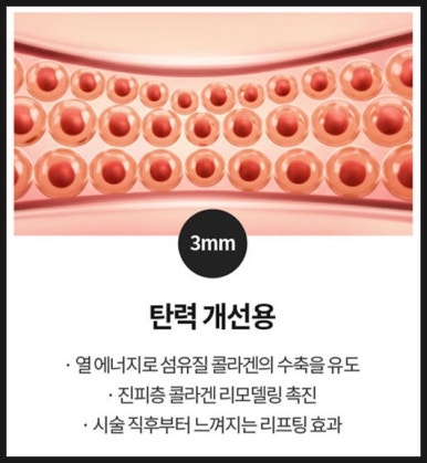 [닥터벨뷰 칼럼 86.]울쎄라(HIFU), 써마지(RF), 그리고 벨뷰에 새로 도입된 온다 리프팅 비교 관련 이미지 11
