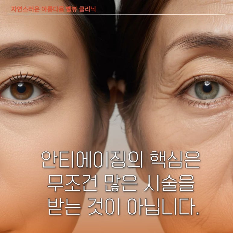 [닥터벨뷰 칼럼 111.] 1년에 딱 한 번으로 끝내는 타임머신 치트키, 써마지와 궁합 최고인 3가지 시술 관련 이미지 7