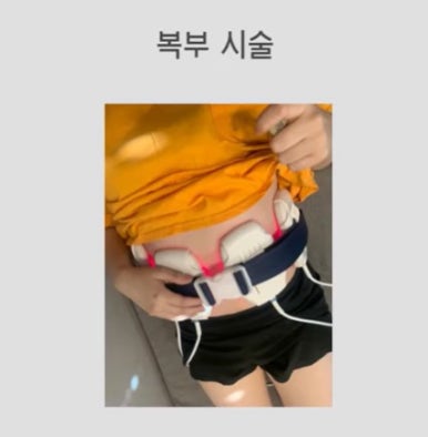 똘똘 뭉친 셀룰라이트로 고민해보셨나요? (feat. 노블쉐이프) 피부과에서 편하게 받는 셀룰라이트 치료 관련 이미지 8