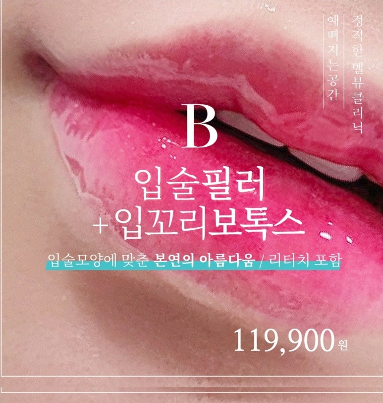 벨뷰의원 입술 필러, 입꼬리 필러, 입꼬리 보톡스 효과, 시술방법, 비용 관련 이미지 10
