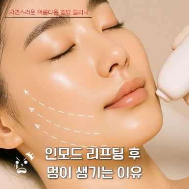 The Battle Between Microwaves and Radiofrequency: How to Choose a Customized Lifting Treatment for Your Face Shape [ONDA vs. InMode] image 6