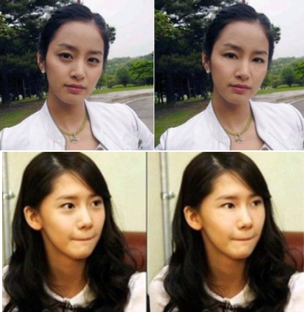 고급진 김지원 턱선이 부러워요! 한끗차이로 완성되는 세련미(턱끝필러) 관련 이미지 3