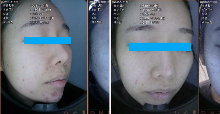 포텐자 치료 효과, 일본인에게 특히 인기인 이유는? 관련 이미지 10