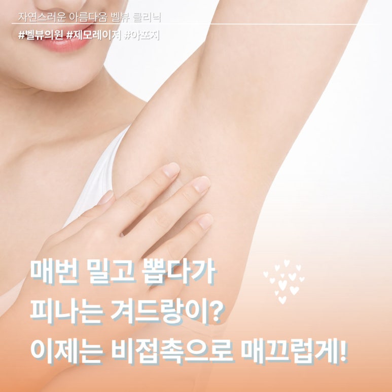 벌써 여름 휴가 D-30, 지금 당장 레이저 제모를 시작해야 하는 이유 관련 이미지 4