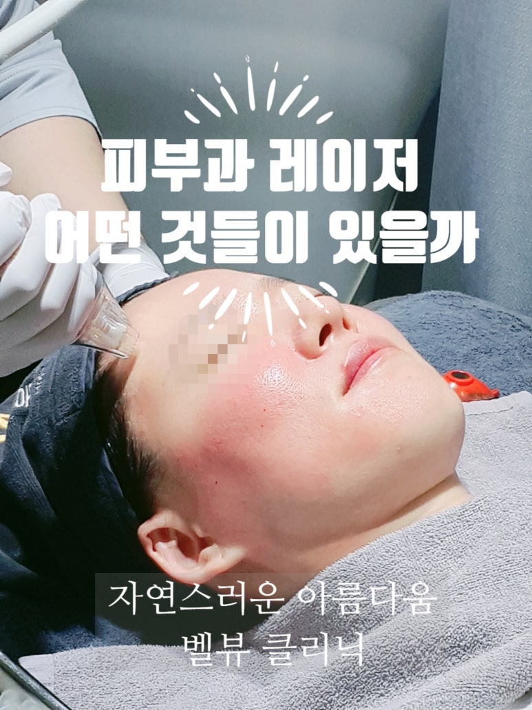 2024 가장 인기있는 피부과 레이저 알아보기 관련 이미지 1