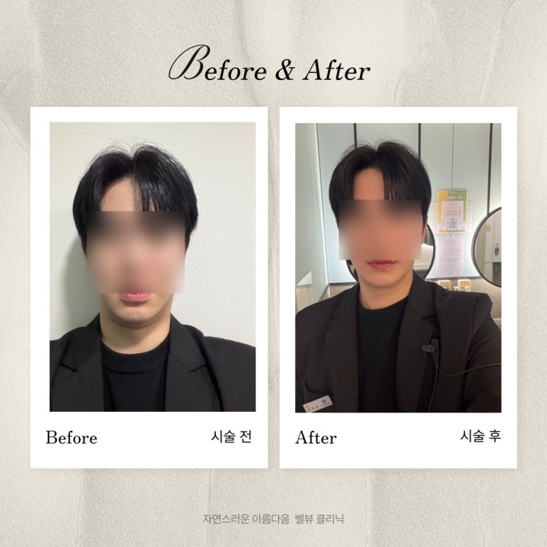 온다 vs 인모드, 뭐가 다를까? 당신의 선택은? 관련 이미지 2