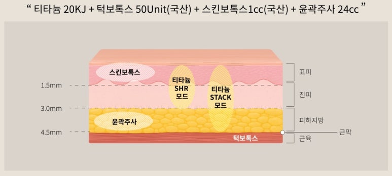 리프팅 입문자들을 위한 네 가지 프로그램, 벨뷰로 다 모여라! 관련 이미지 9