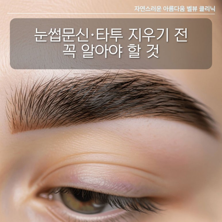 눈썹문신·타투 지우기 전 꼭 알아야 할 레이저 선택 기준 (나노초 vs 피코초) 관련 이미지 1