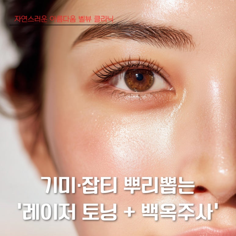 기미·잡티를 뿌리뽑는 치트키 ‘레이저 토닝 + 백옥주사’ 관련 이미지 1