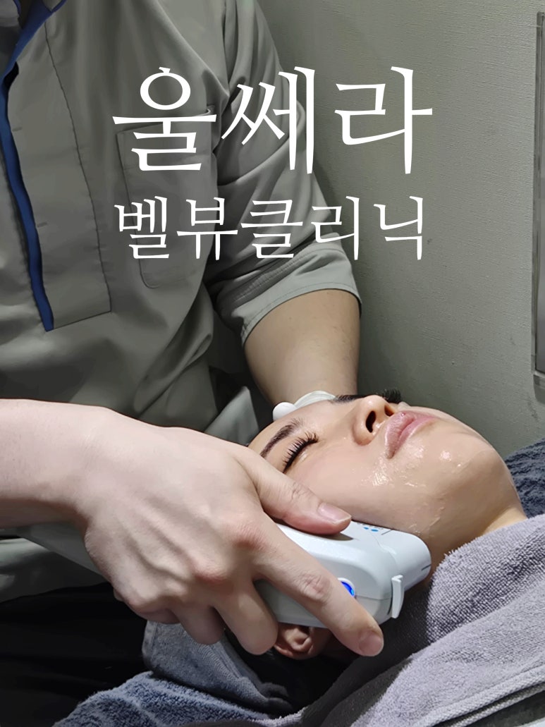 How to Double the Results of Ultherapy: A Complete A-to-Z Guide image 1