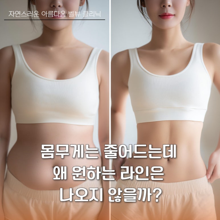 지방은 빼고 라인은 살리고! 스테로이드 걱정 없는 라인팻 주사 관련 이미지 2