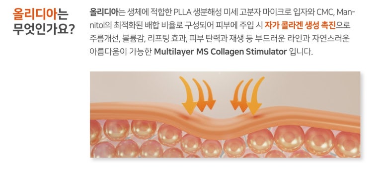 [닥터벨뷰 칼럼 104.] 결절 우려 없는 콜라겐 부스터는 없을까? 관련 이미지 4