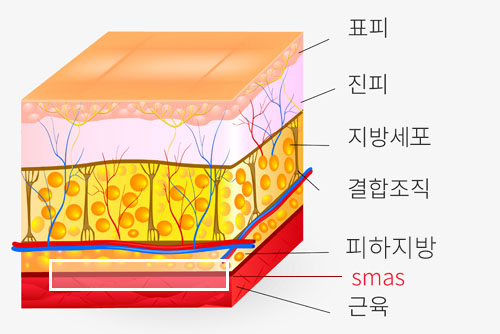 울쎄라 효과 왜 한 달은 기다려야 할까요? 관련 이미지 3