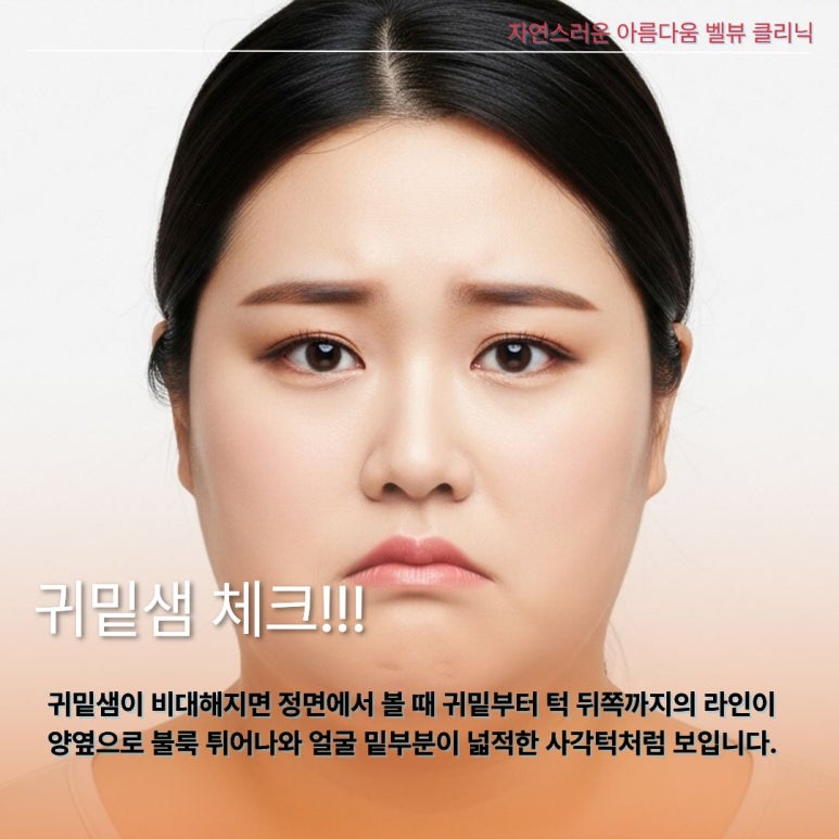 턱살인 줄 알았는데 침샘이라고? 귀밑&middot;턱밑 불룩함 해결하는 침샘 비대증 원인과 진단 관련 이미지 3