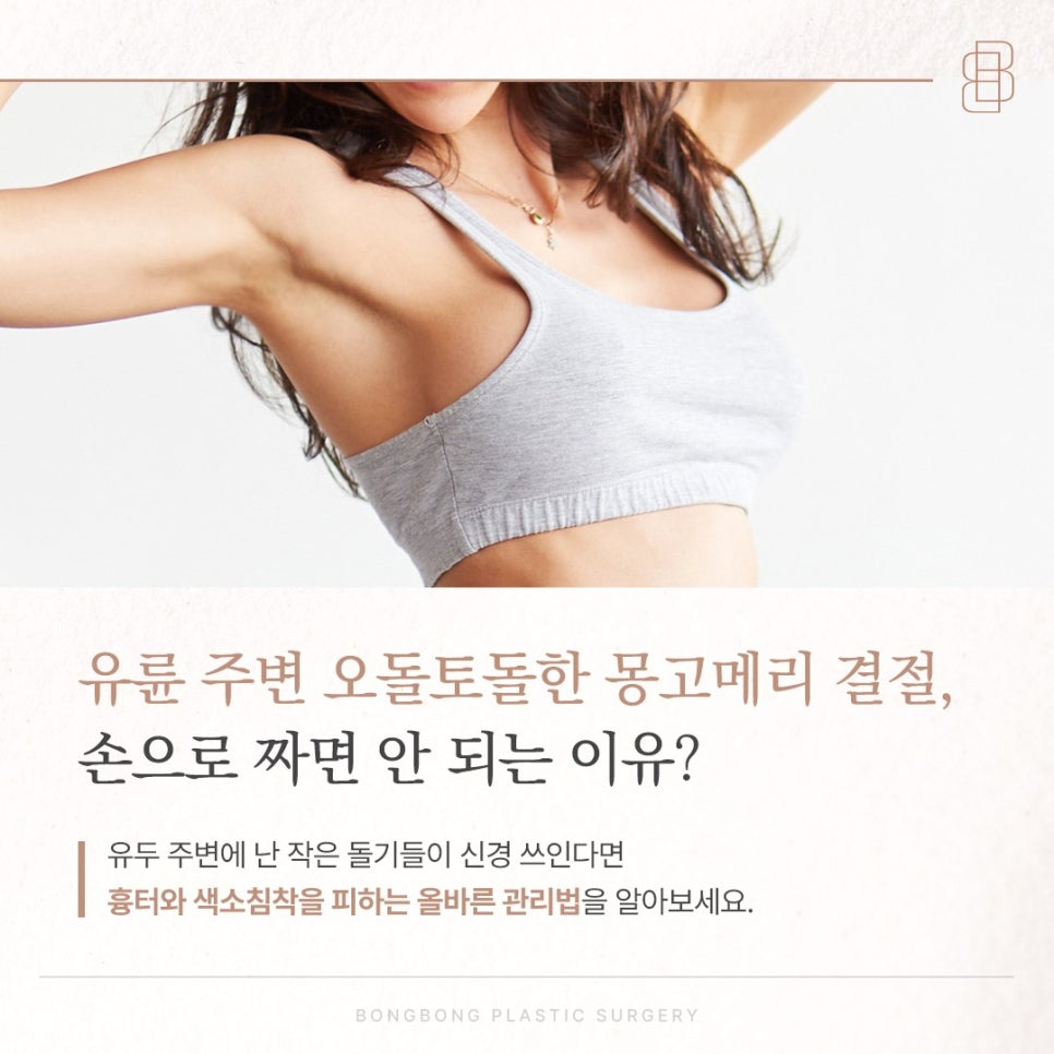 몽고메리결절 유두 유륜 정상 범위와 제거를 결정하는 기준 4가지 관련 이미지 1