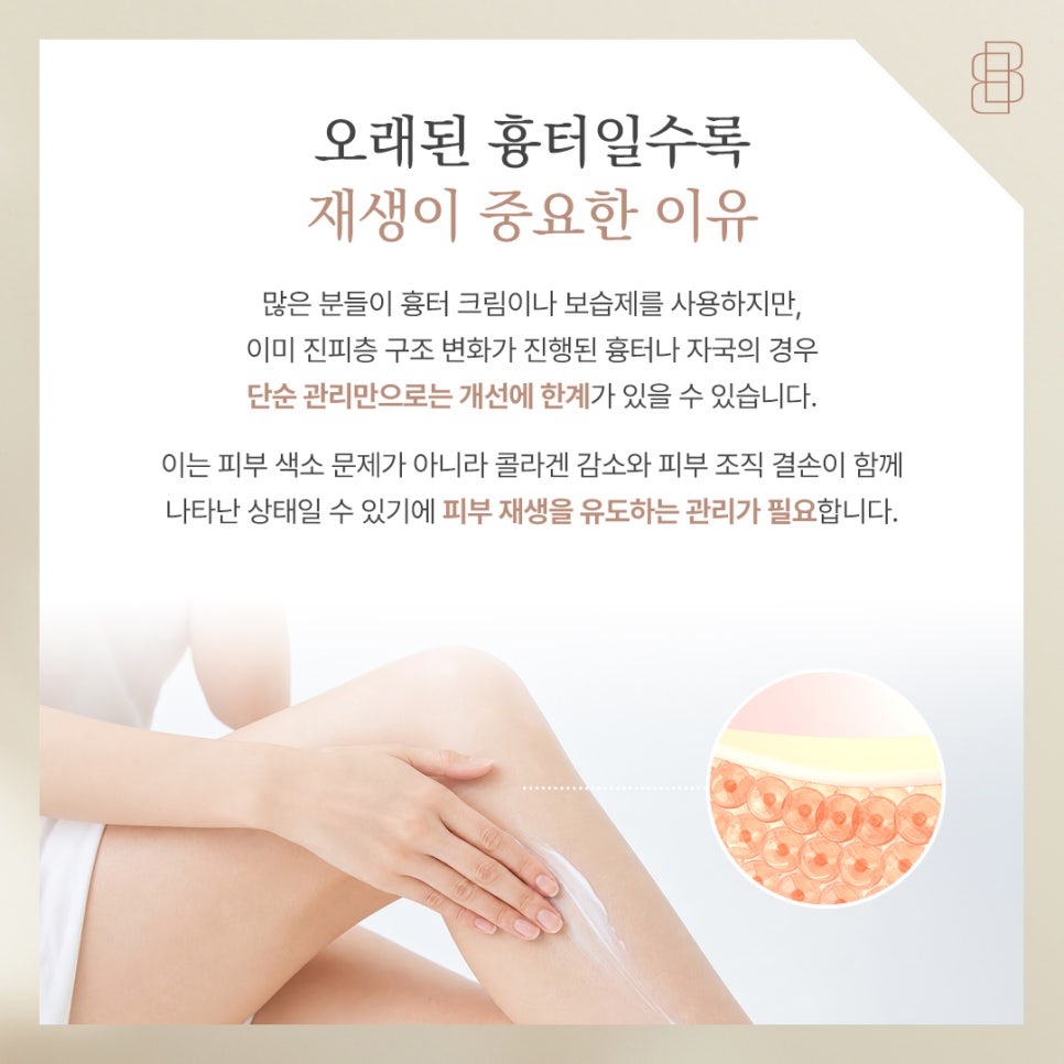 미라젯 흉터 케어 가이드 오래된 패인 자국 진피층 재생으로 말끔하게 관련 이미지 3