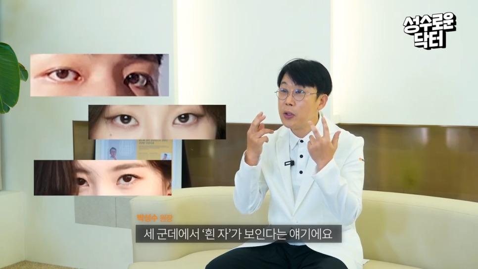 성형 후 삼백안 관상 변화할 수 있을까?! 관련 이미지 4